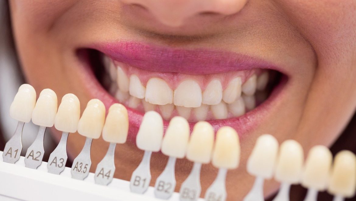 מהם הטכניקות ליישור שיניים בקרב מבוגרים?